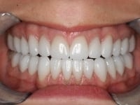 Konig Center for Cosmetic & Comprehensive Dentistry smile photos
